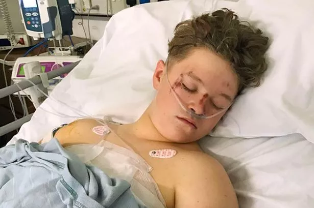 "Rugby training saved his life," says brother of young starlet hit by car at 60mph